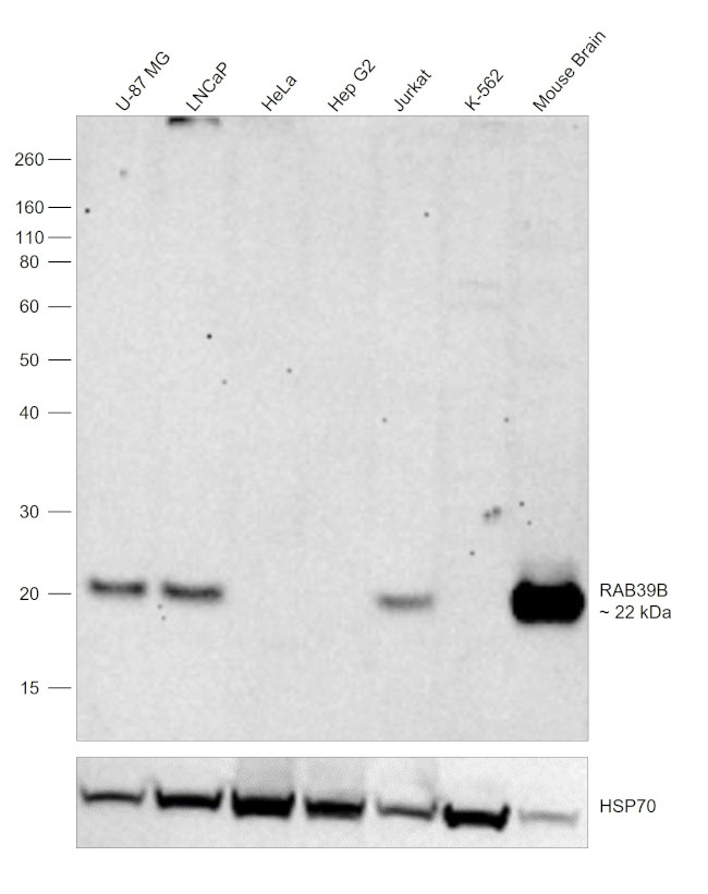 RAB39B Antibody in Western Blot (WB)