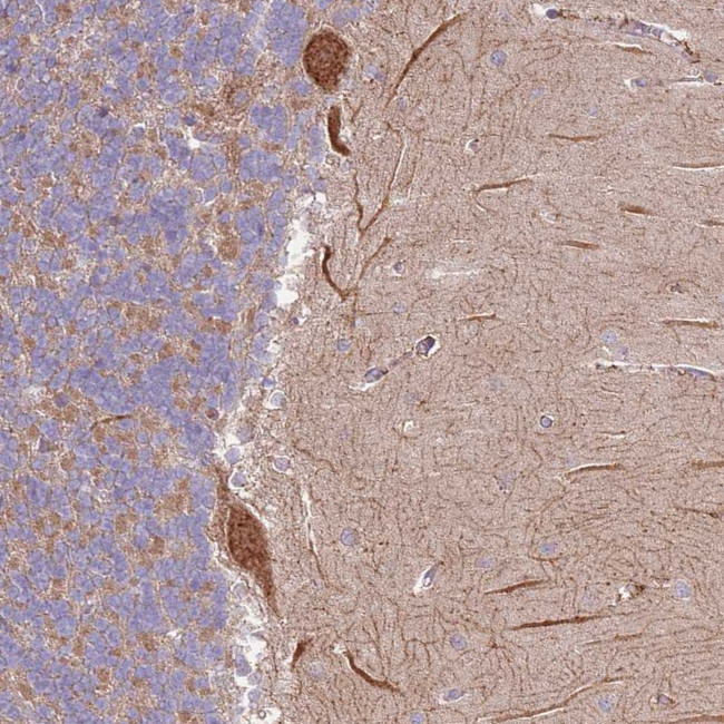 C14orf126 Antibody in Immunohistochemistry (IHC)