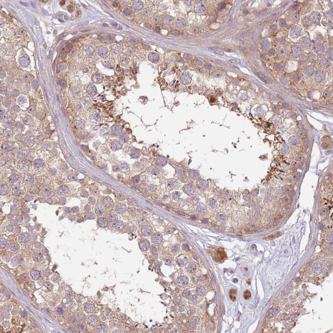 C14orf126 Antibody in Immunohistochemistry (IHC)