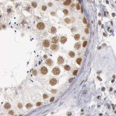 DGCR14 Antibody in Immunohistochemistry (IHC)