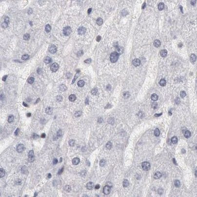 DGCR14 Antibody in Immunohistochemistry (IHC)