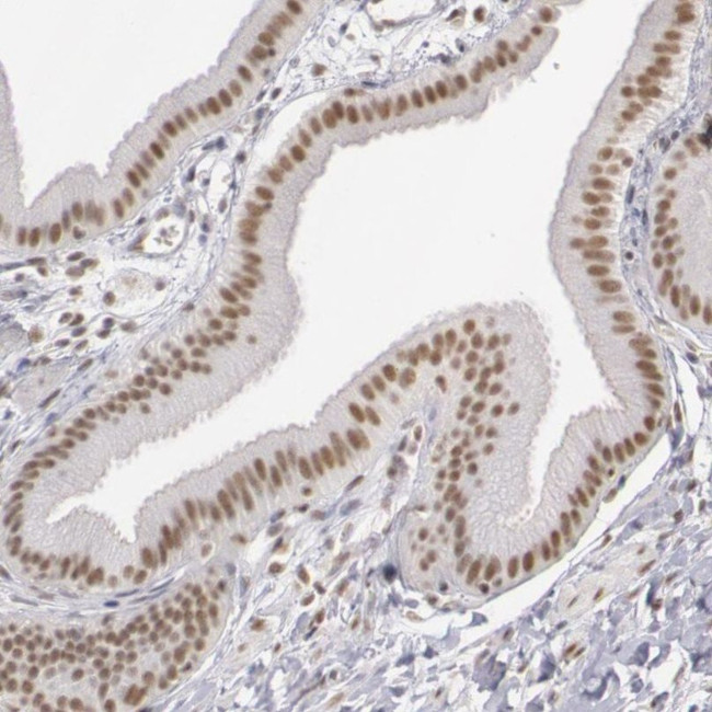 DGCR14 Antibody in Immunohistochemistry (IHC)