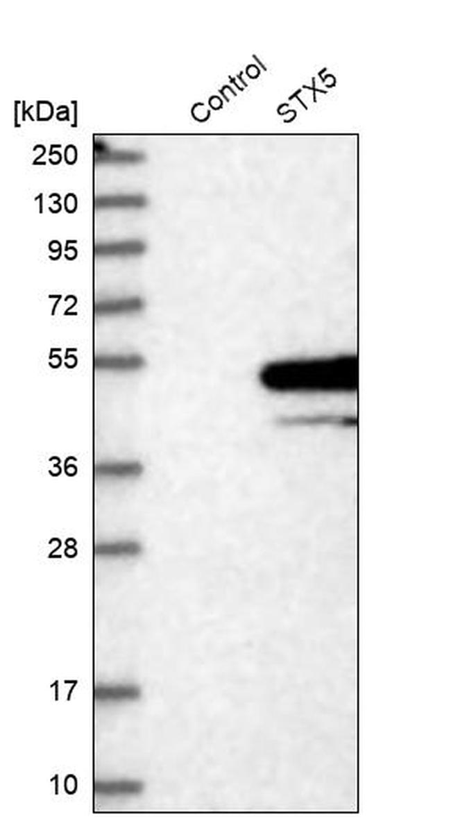 STX5 Antibody in Western Blot (WB)