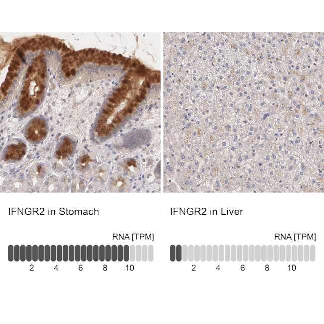 IFNGR2 Antibody