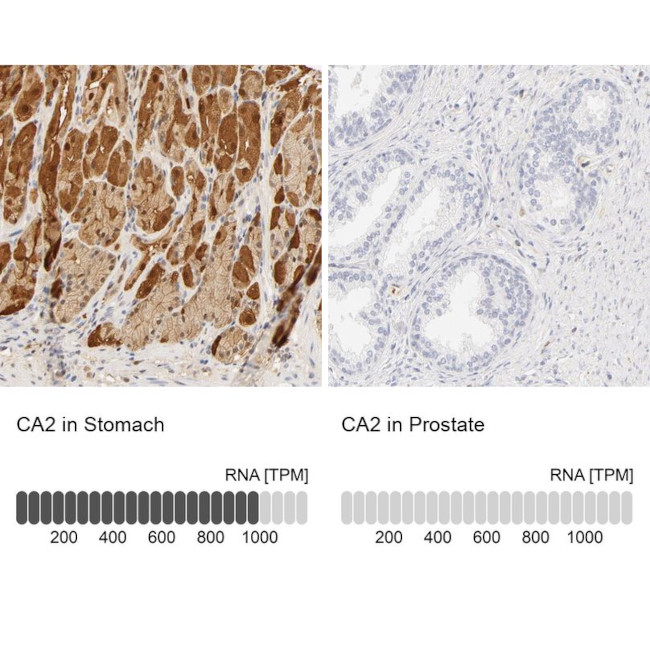 Carbonic Anhydrase II Antibody in Immunohistochemistry (IHC)