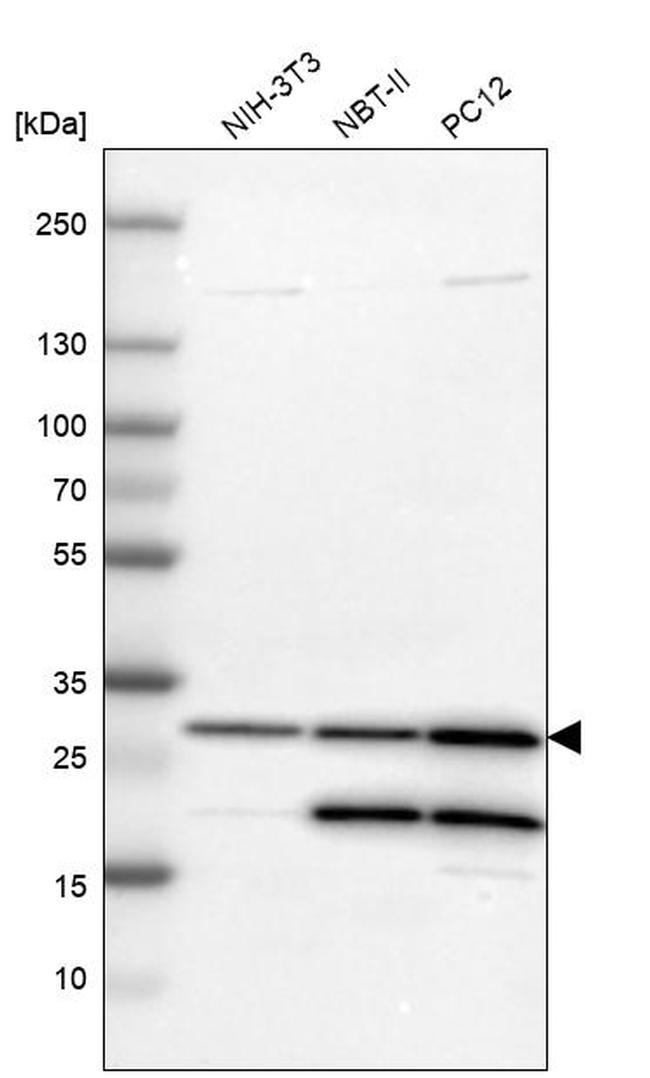 Carbonic Anhydrase II Antibody in Western Blot (WB)