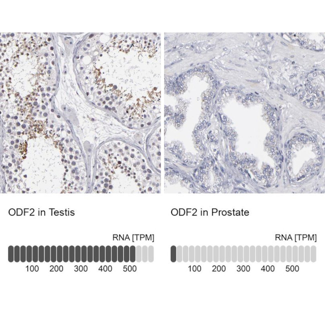 ODF2 Antibody in Immunohistochemistry (IHC)