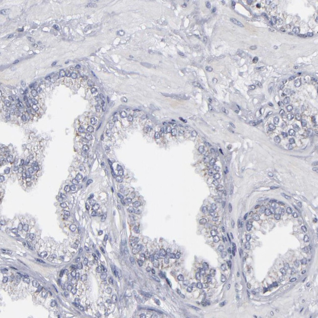 ODF2 Antibody in Immunohistochemistry (IHC)