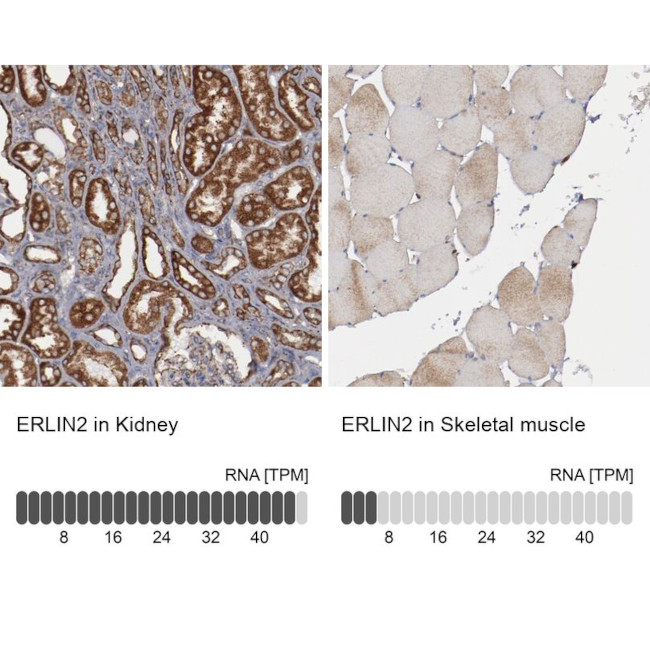 ERLIN2 Antibody in Immunohistochemistry (IHC)