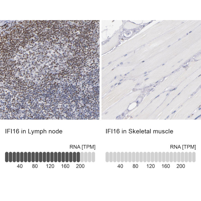 IFI16 Antibody