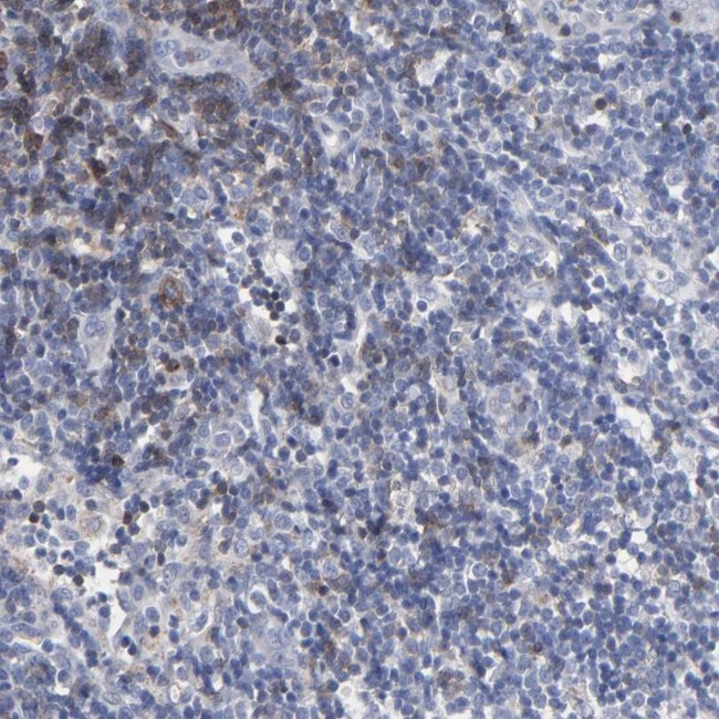 TRIM Antibody in Immunohistochemistry (IHC)