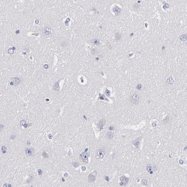 TRIM Antibody in Immunohistochemistry (IHC)