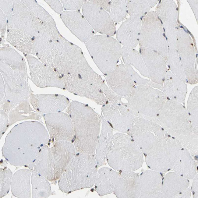 eIF1AX Antibody in Immunohistochemistry (IHC)