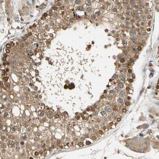 eIF1AX Antibody in Immunohistochemistry (IHC)