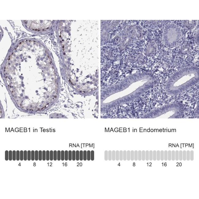 MAGEB1 Antibody in Immunohistochemistry (IHC)