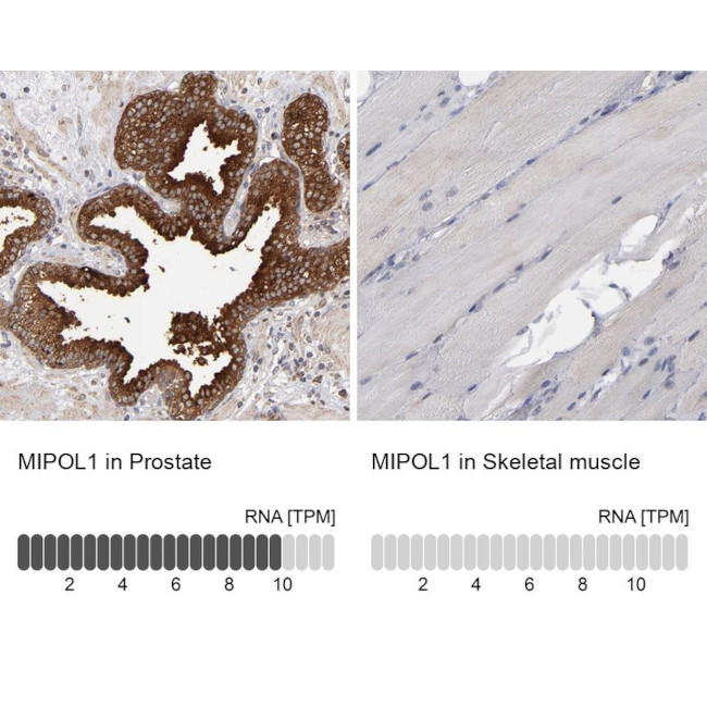 MIPOL1 Antibody in Immunohistochemistry (IHC)