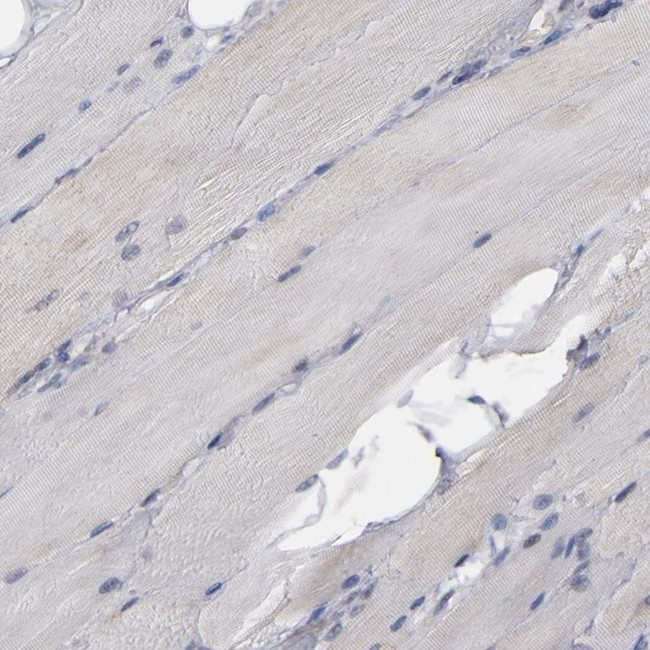 MIPOL1 Antibody in Immunohistochemistry (IHC)