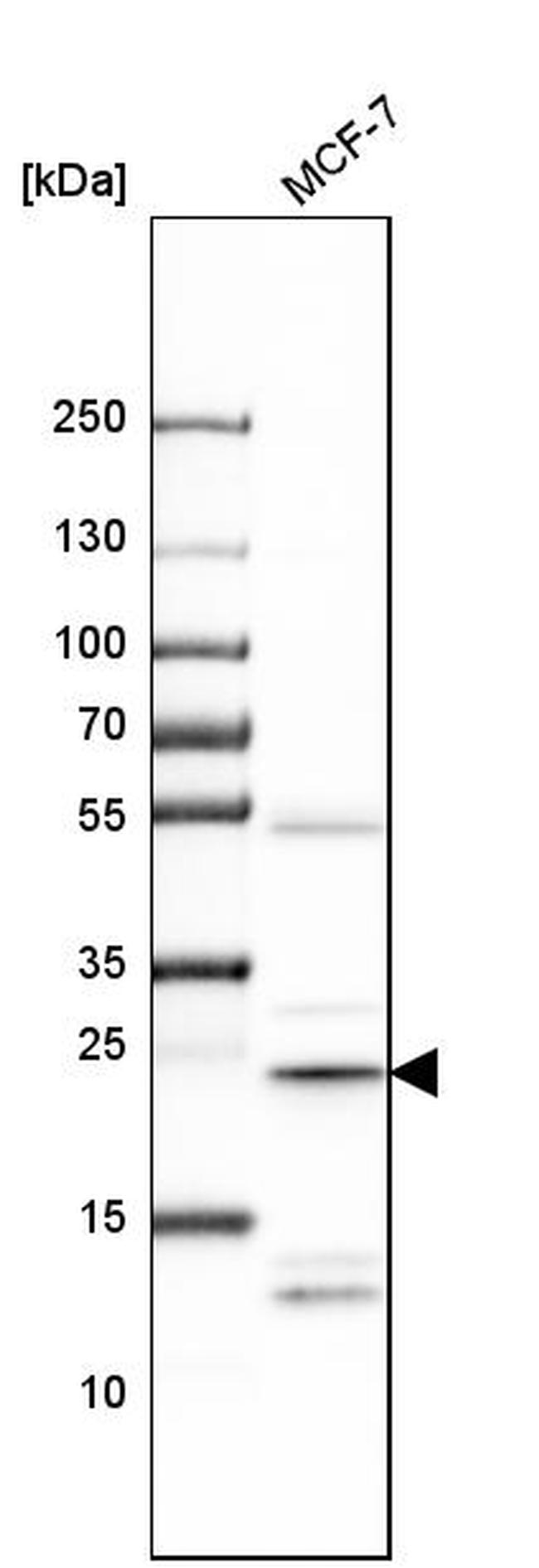 PSMD10 Antibody in Western Blot (WB)