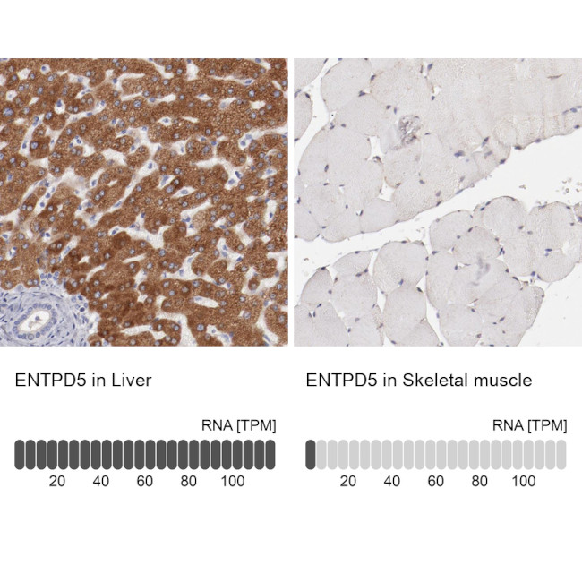 ENTPD5 Antibody in Immunohistochemistry (IHC)