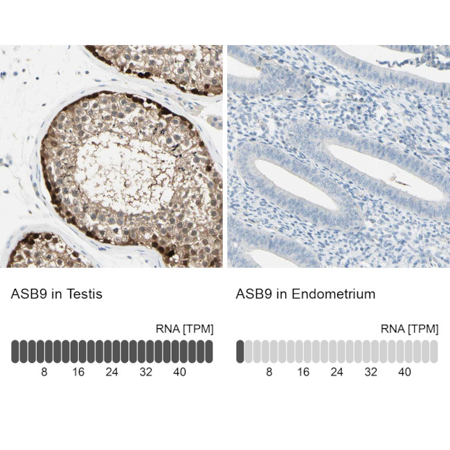 ASB9 Antibody in Immunohistochemistry (IHC)