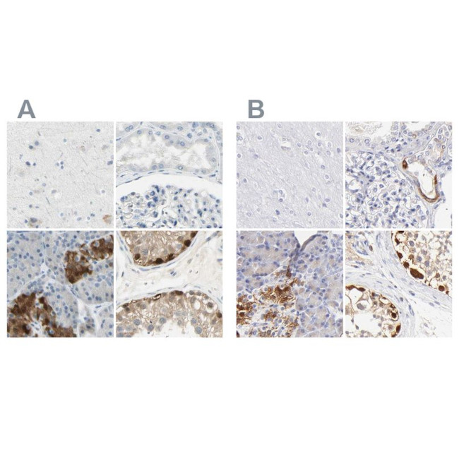 ASB9 Antibody in Immunohistochemistry (IHC)