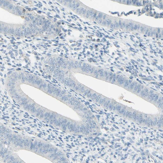 ASB9 Antibody in Immunohistochemistry (IHC)