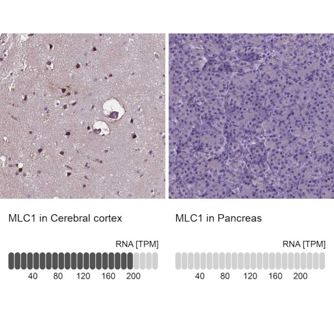 MLC1 Antibody in Immunohistochemistry (IHC)