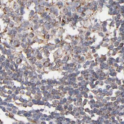 KTN1 Antibody in Immunohistochemistry (IHC)