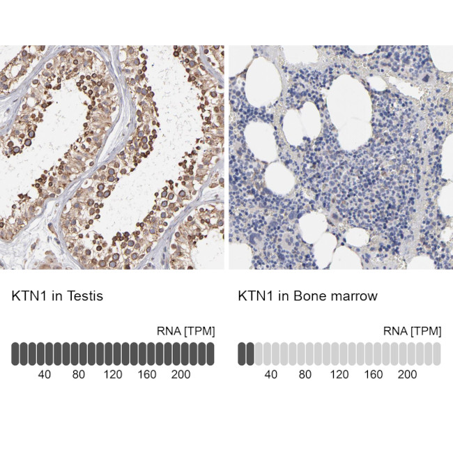 KTN1 Antibody