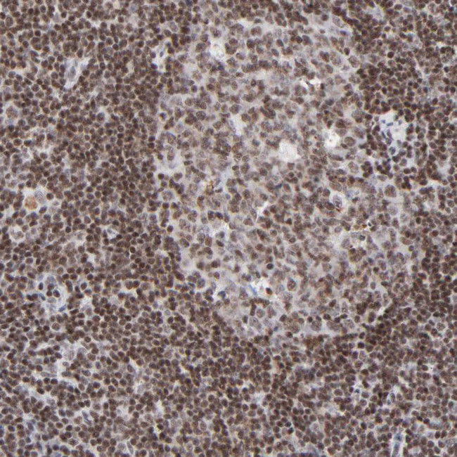 ZNF143 Antibody in Immunohistochemistry (IHC)
