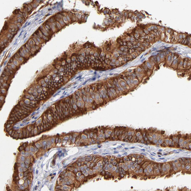 CD2AP Antibody in Immunohistochemistry (IHC)