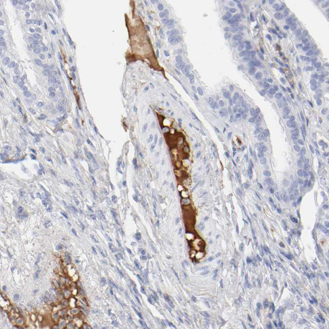 tPA Antibody in Immunohistochemistry (IHC)