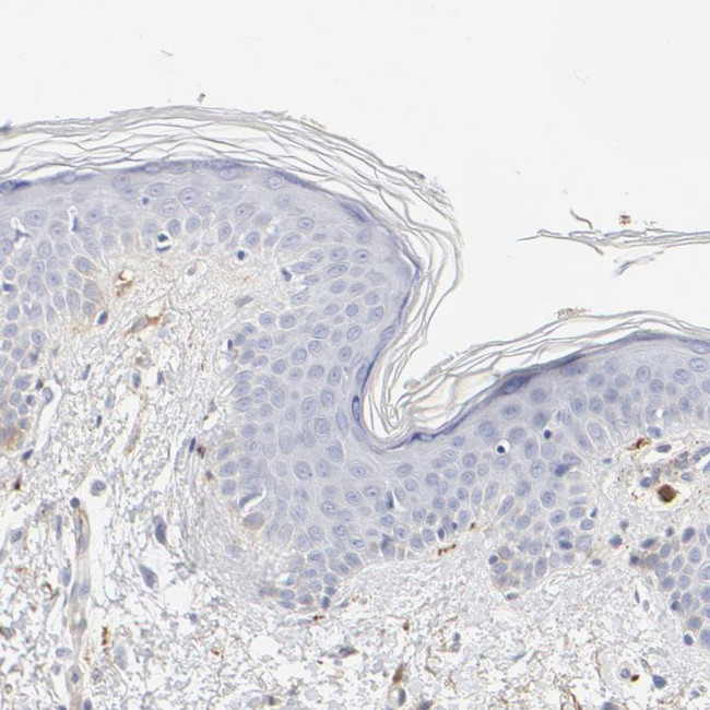 tPA Antibody in Immunohistochemistry (IHC)