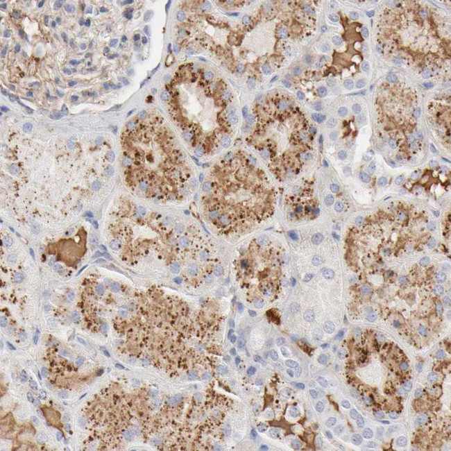 tPA Antibody in Immunohistochemistry (IHC)