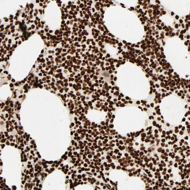 HMGB2 Antibody in Immunohistochemistry (IHC)