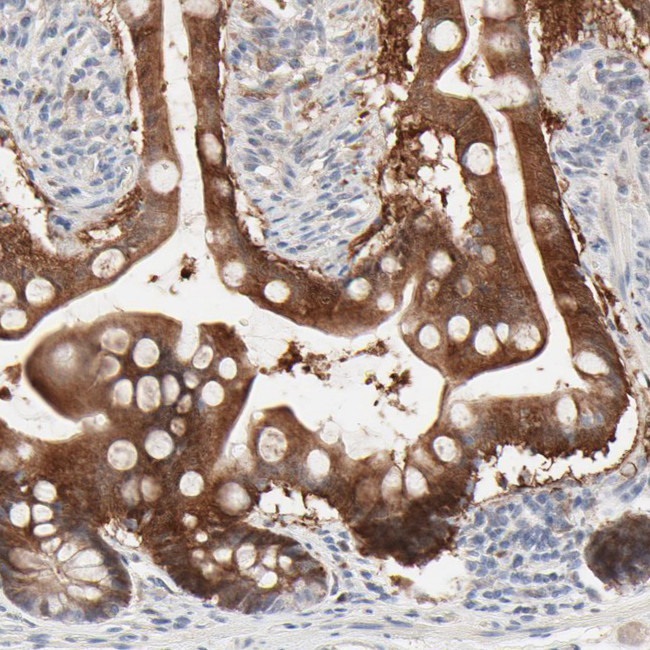 Galectin 2 Antibody in Immunohistochemistry (IHC)