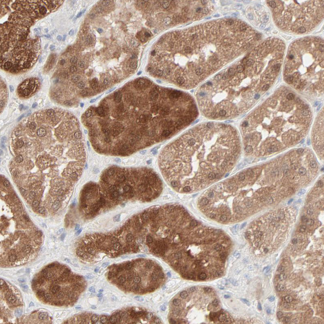 Galectin 2 Antibody in Immunohistochemistry (IHC)