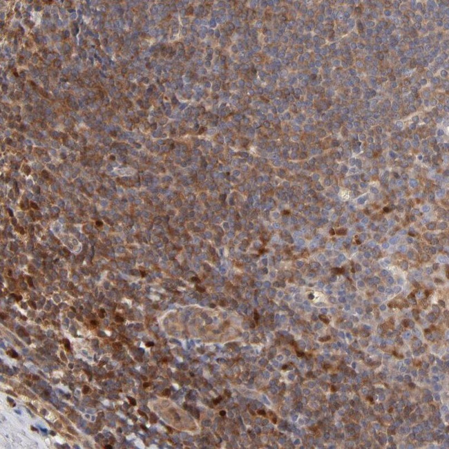 ARHGEF6 Antibody in Immunohistochemistry (IHC)