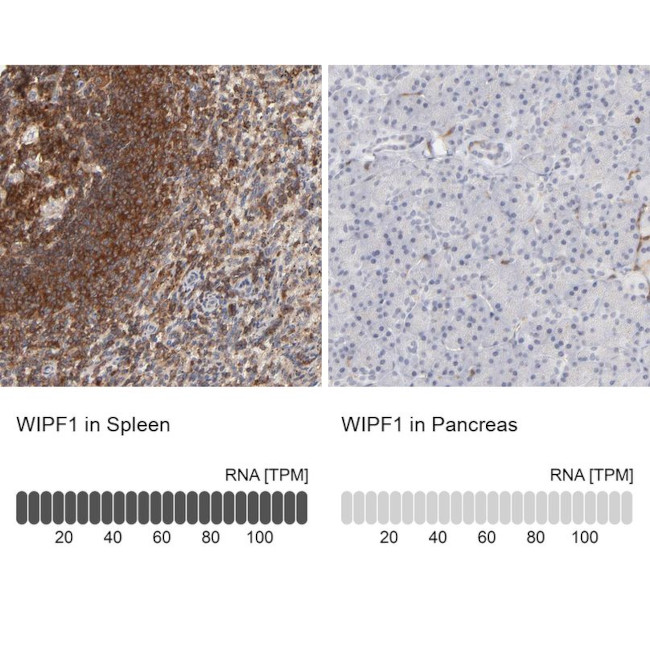 WIPF1 Antibody in Immunohistochemistry (IHC)