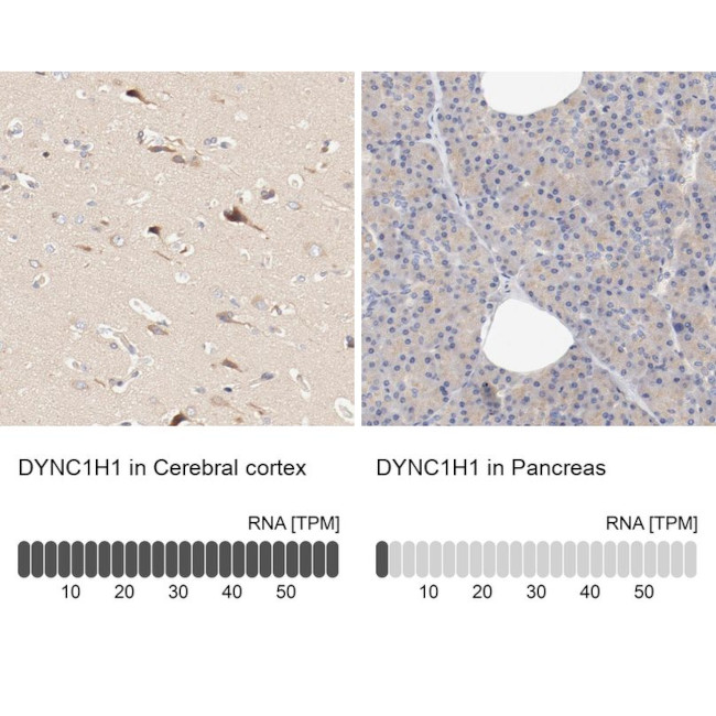 DYNC1H1 Antibody in Immunohistochemistry (IHC)