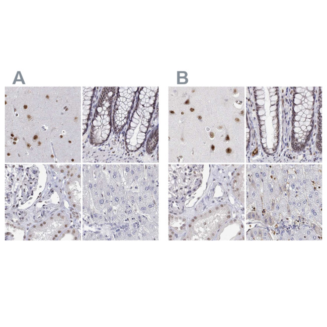 ADAR Antibody in Immunohistochemistry (IHC)