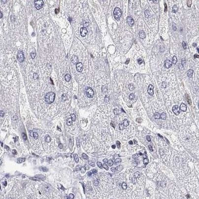 ADAR Antibody in Immunohistochemistry (IHC)