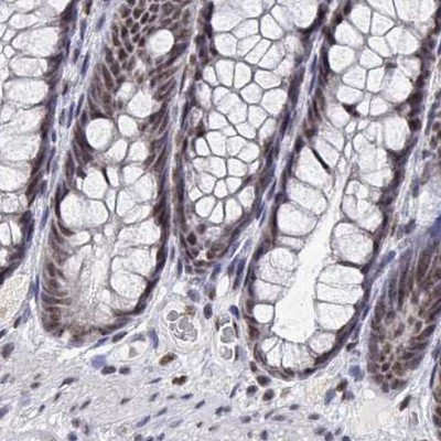 ADAR Antibody in Immunohistochemistry (IHC)