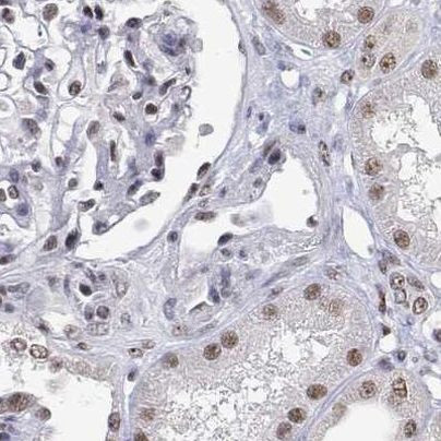 ADAR Antibody in Immunohistochemistry (IHC)