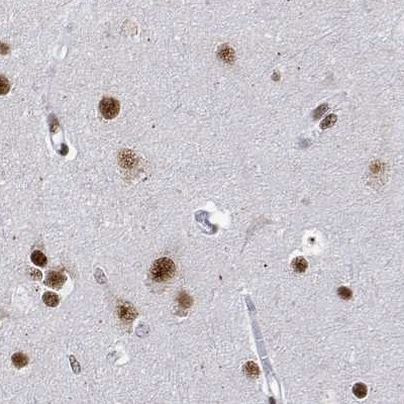 ADAR Antibody in Immunohistochemistry (IHC)