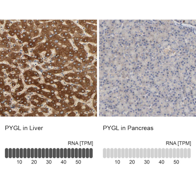 PYGL Antibody in Immunohistochemistry (IHC)