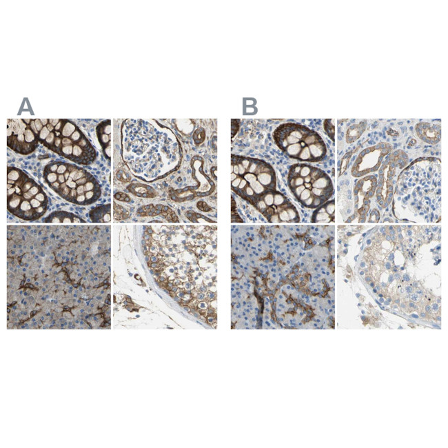 Filamin B Antibody in Immunohistochemistry (IHC)