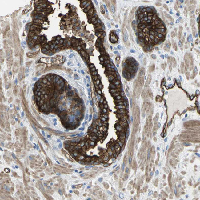 Filamin B Antibody in Immunohistochemistry (IHC)