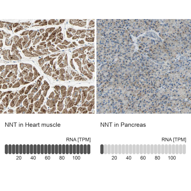NNT Antibody in Immunohistochemistry (IHC)