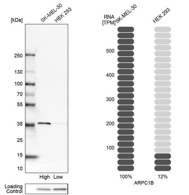 p41-ARCb Antibody in Western Blot (WB)